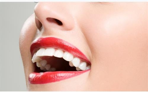 Billboard Smiles Teeth whitening