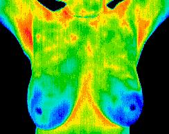 Thermography Centers, Radiant Health Thermography, Inc