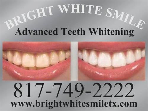 BRIGHT WHITE SMILE