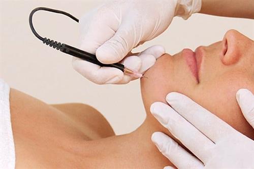 Beautique Electrolysis