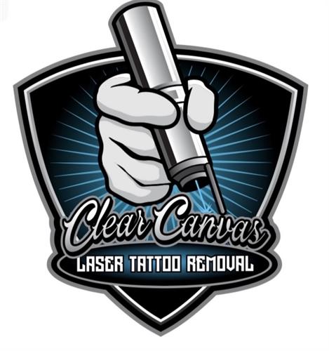 Clear Canvas Laser Tattoo Removal