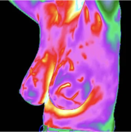 Thermography Technician